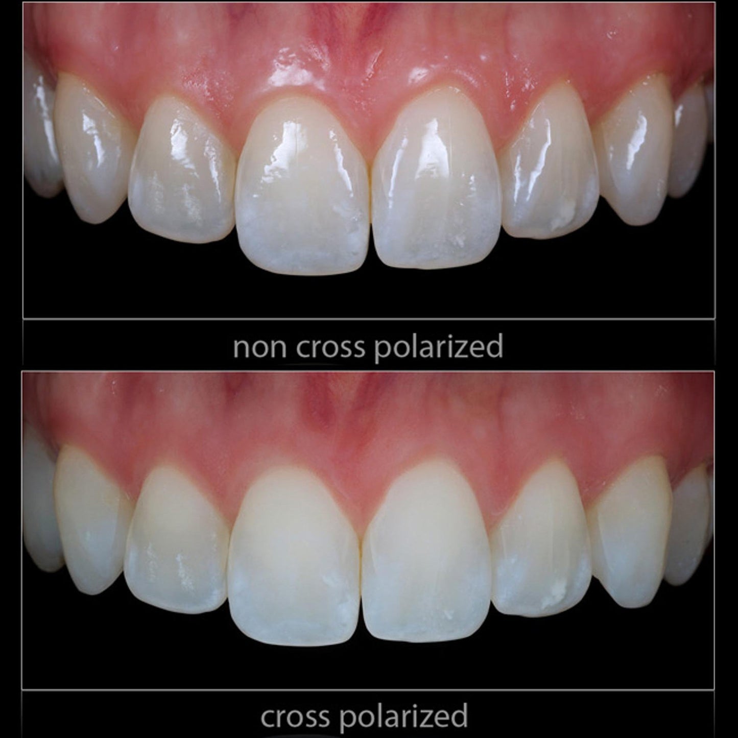Cross Polarization Set For GODOX MF-R76